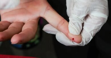 teste rápido da dengue