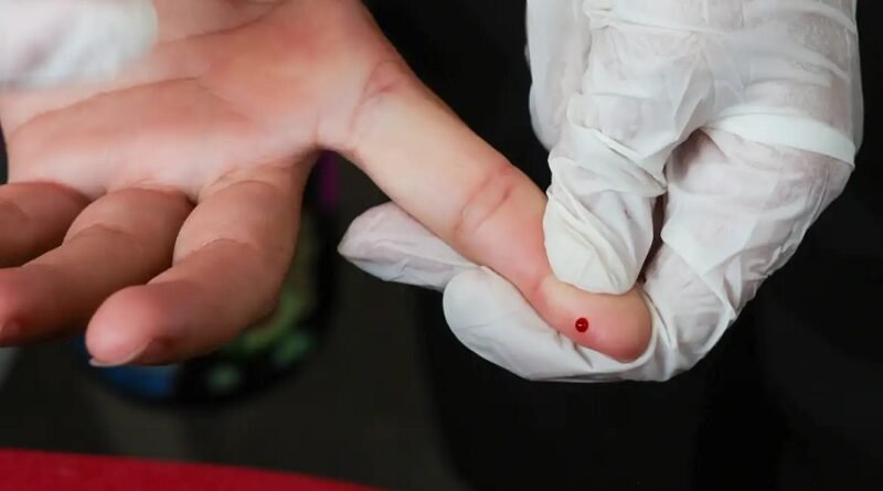 teste rápido da dengue